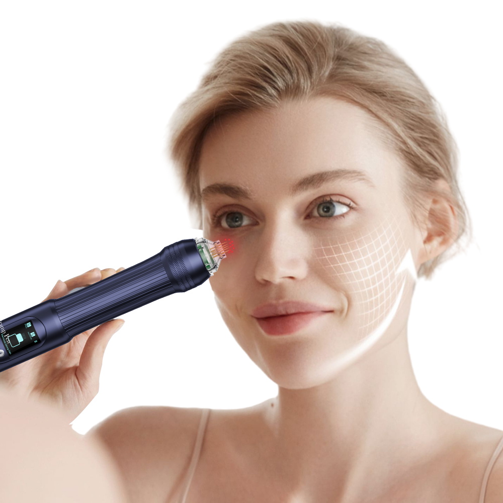 Elektrodenbetriebenes Microneedling Derma Pen Microcurrent RF LED Persönliches Schönheitsgerät