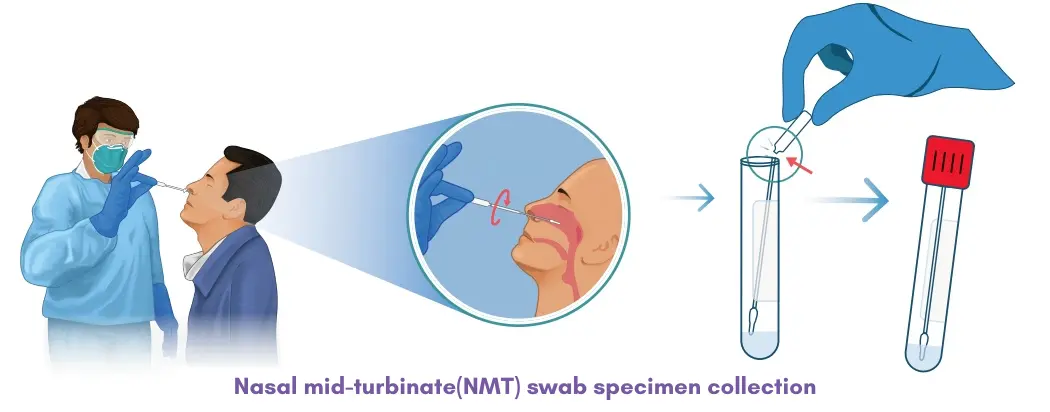 Nasal mid-turbinate(NMT) swab specimen collection