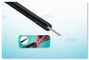 Bronchoscopic High-Frequency Electrosurgical Knife