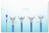 Disposable Biopsy Forceps
